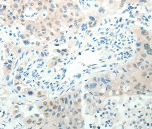 RAB25 Polyclonal Antibody - image 1