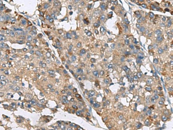 IP6K2 Polyclonal Antibody - image 1