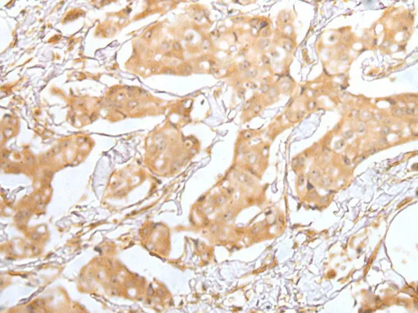 GRAP Polyclonal Antibody - image 1
