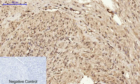 BRCA1 Polyclonal Antibody - image 1
