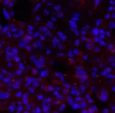 BRCA1 Polyclonal Antibody - image 2