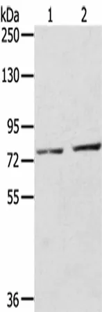 ECE2 Polyclonal Antibody - image 1