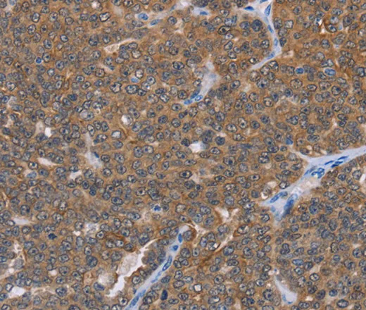 FABP6 Polyclonal Antibody - image 1