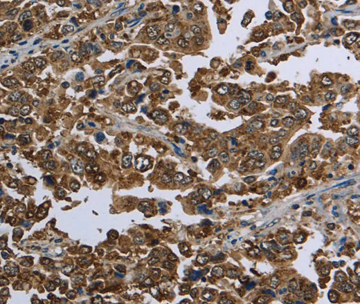 HSPA9 Polyclonal Antibody - image 1