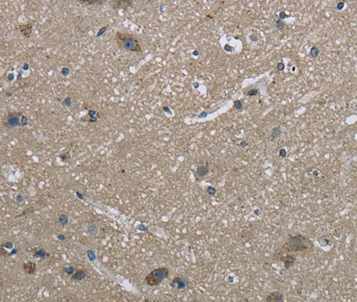 HSPA9 Polyclonal Antibody - image 2