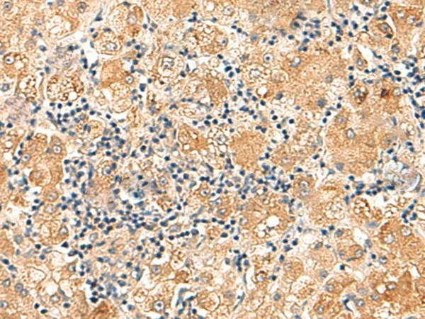 EIF3K Polyclonal Antibody - image 1
