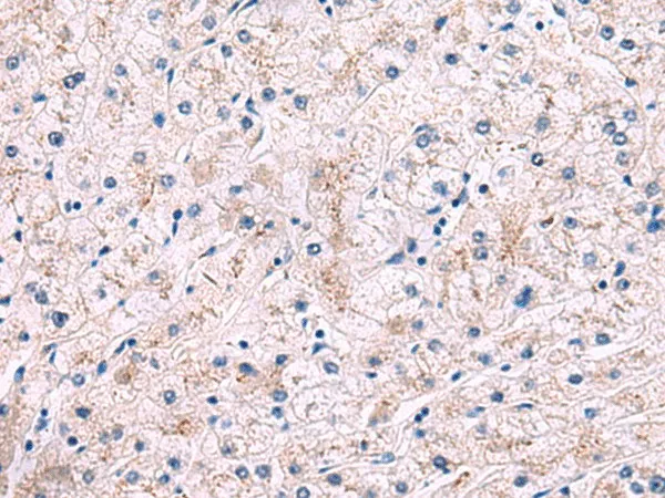 IP6K2 Polyclonal Antibody - image 1