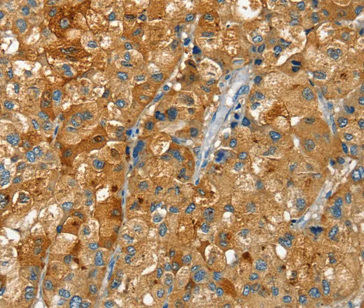 RAB25 Polyclonal Antibody - image 1