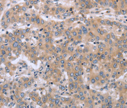 ECE1 Polyclonal Antibody - image 1