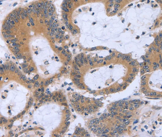 ECE1 Polyclonal Antibody - image 2