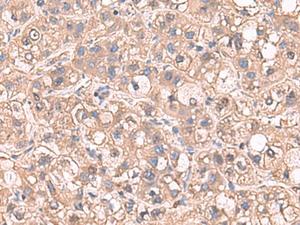 SARS Polyclonal Antibody - image 1