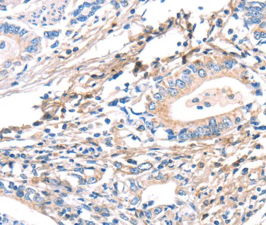 TWF2 Polyclonal Antibody - image 1