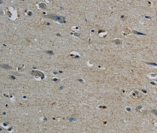 PERK Polyclonal Antibody - image 1