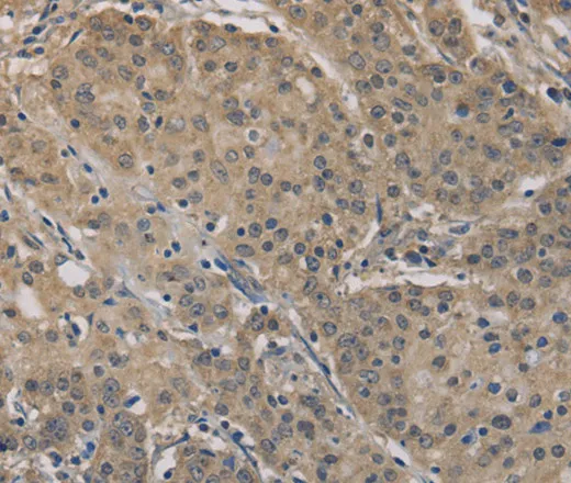 AGTRAP Polyclonal Antibody - image 1