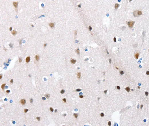 POMC Polyclonal Antibody - image 1