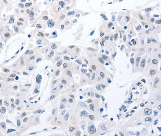 POMC Polyclonal Antibody - image 2