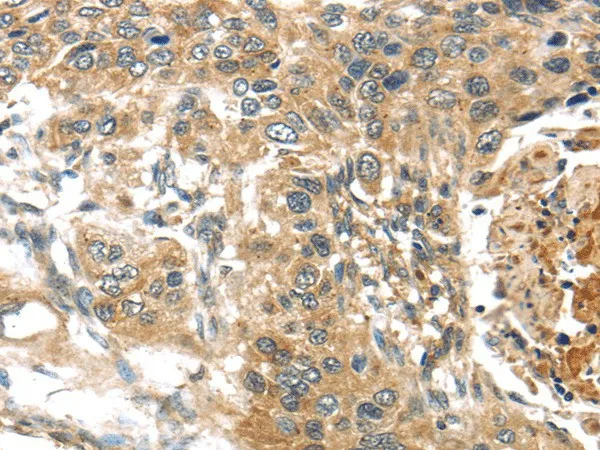 TTI1 Polyclonal Antibody - image 1
