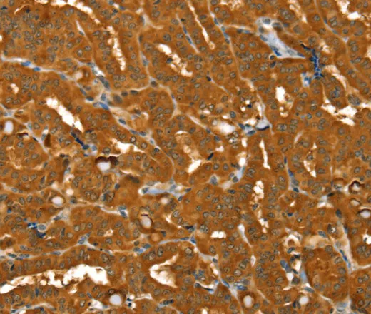 PYGM Polyclonal Antibody - image 1