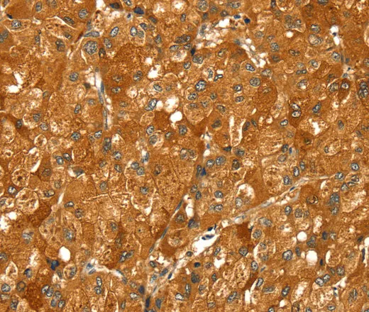 PYGM Polyclonal Antibody - image 2