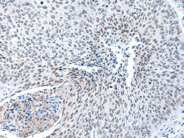MORC2 Polyclonal Antibody - image 1