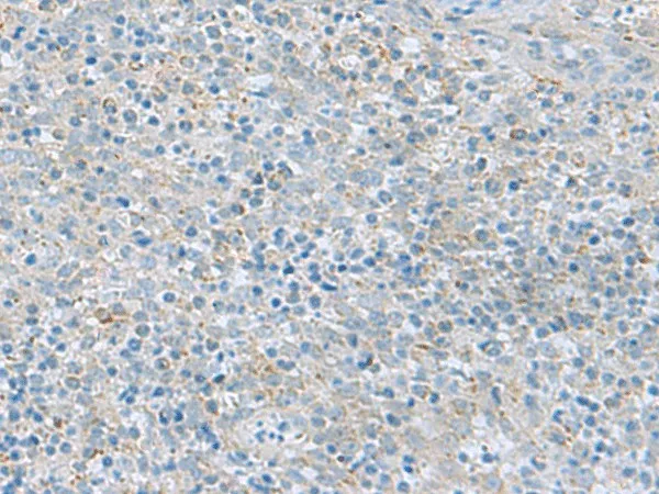 PYCR2 Polyclonal Antibody - image 1