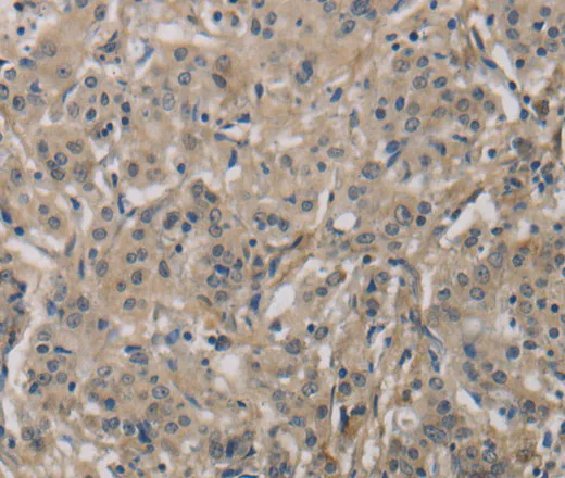 DCN Polyclonal Antibody - image 1