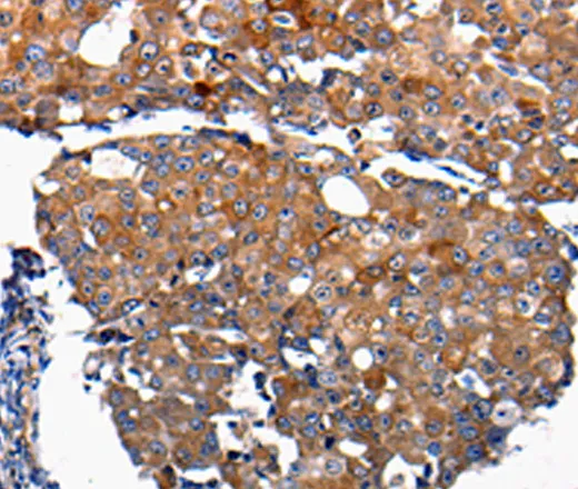 FGF2 Polyclonal Antibody - image 1