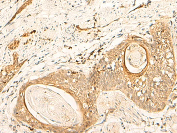 EIF3C Polyclonal Antibody - image 1