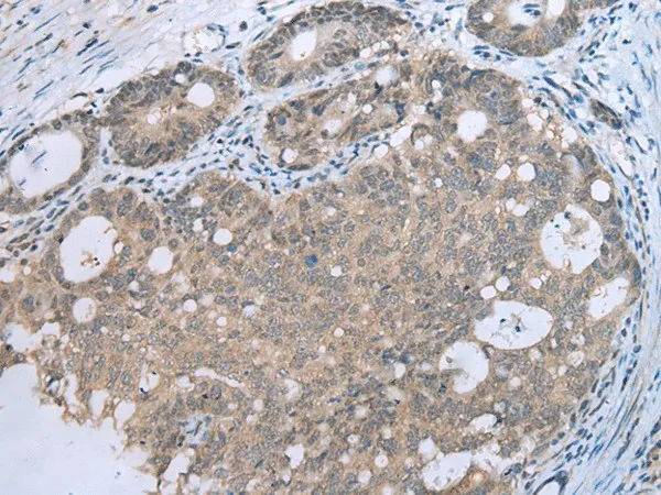 CCNG1 Polyclonal Antibody - image 1