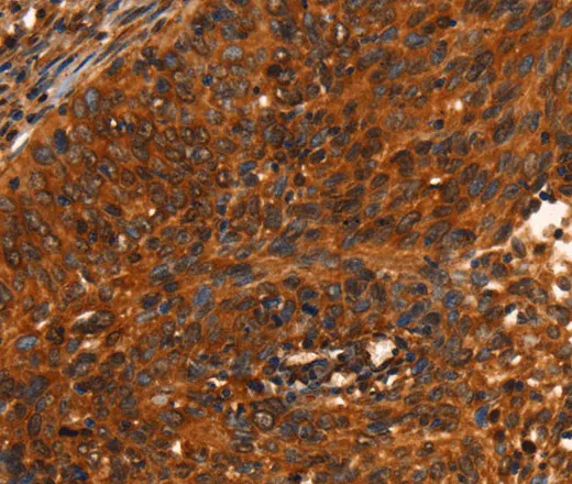 PRKD1 Polyclonal Antibody - image 1