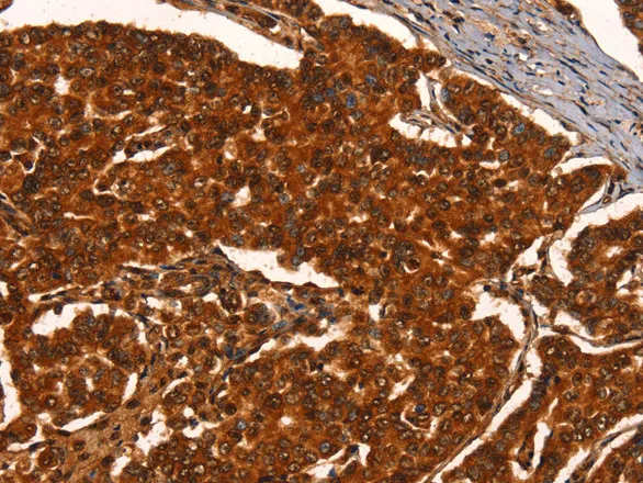 PRKD1 Polyclonal Antibody - image 2