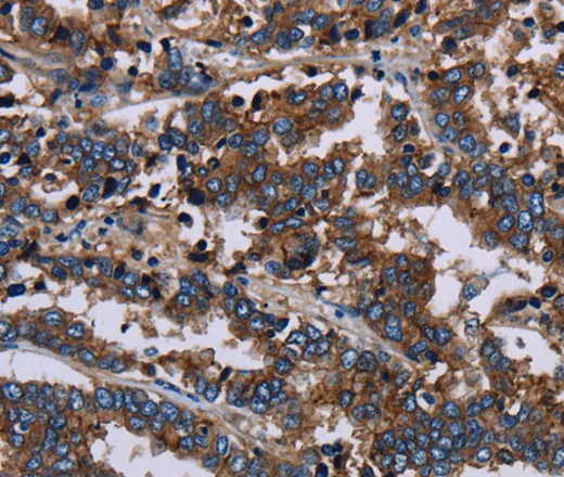 JAM-A Polyclonal Antibody - image 1