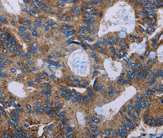 JAM-A Polyclonal Antibody - image 2