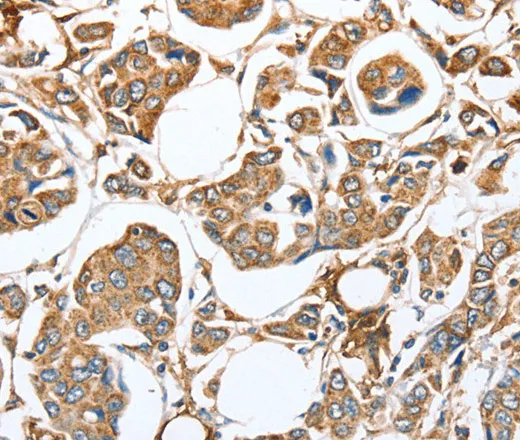 CAPG Polyclonal Antibody - image 1