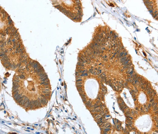 CAPG Polyclonal Antibody - image 2