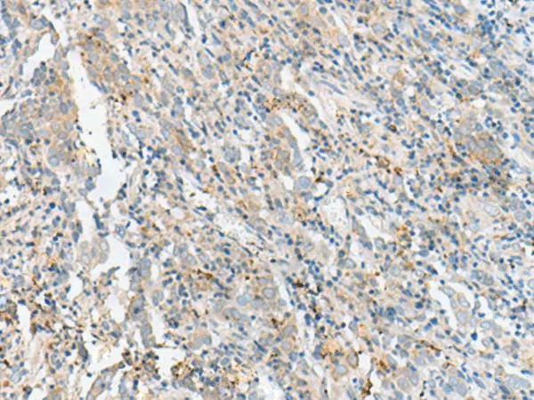 CTRB1 Polyclonal Antibody - image 1