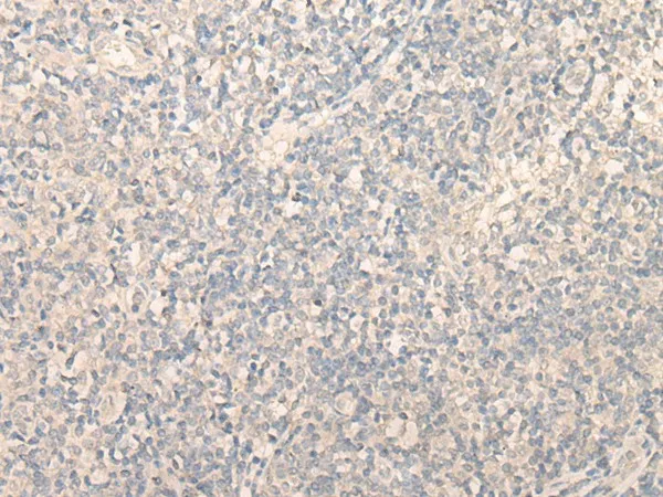 PITPNB Polyclonal Antibody - image 1