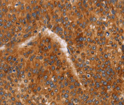 CD38 Polyclonal Antibody - image 1