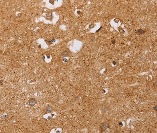 CD38 Polyclonal Antibody - image 2
