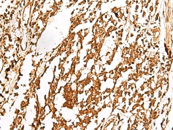 TERF1 Polyclonal Antibody - image 1