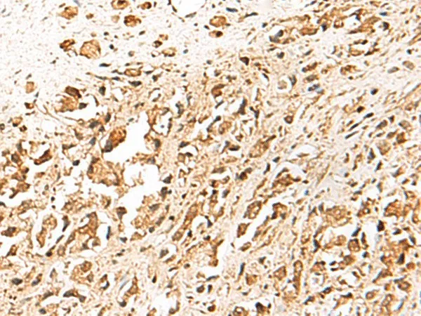 TERF1 Polyclonal Antibody - image 2