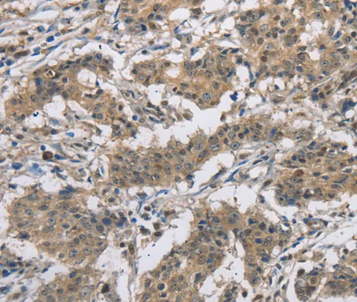 DSG2 Polyclonal Antibody - image 1