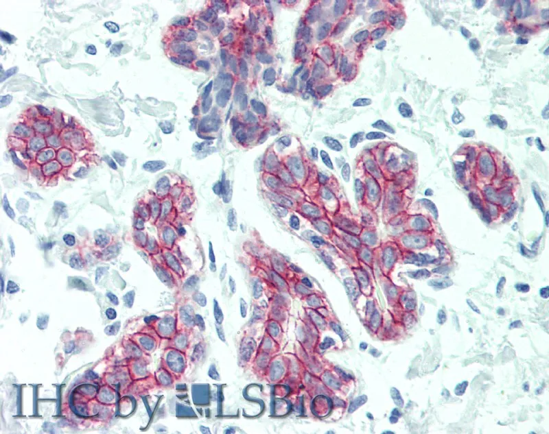DSG2 Polyclonal Antibody - image 2