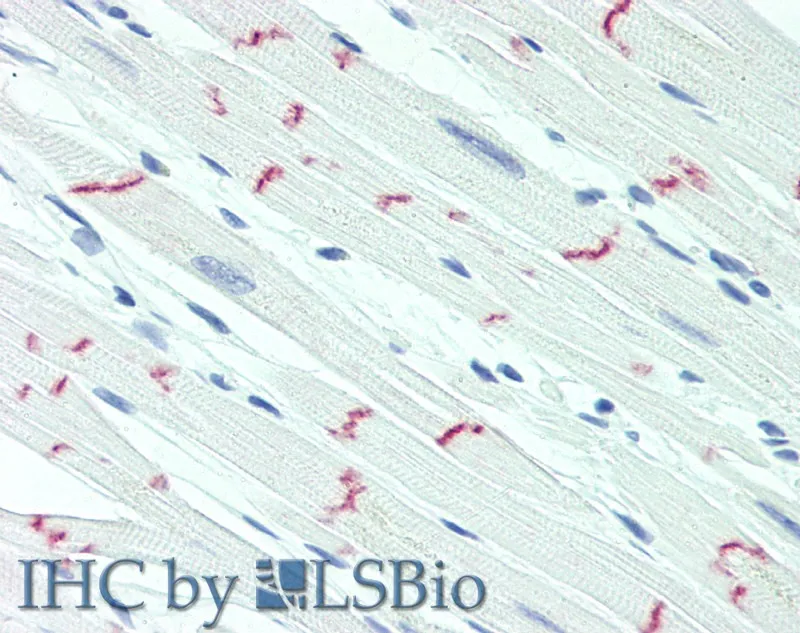 DSG2 Polyclonal Antibody - image 3