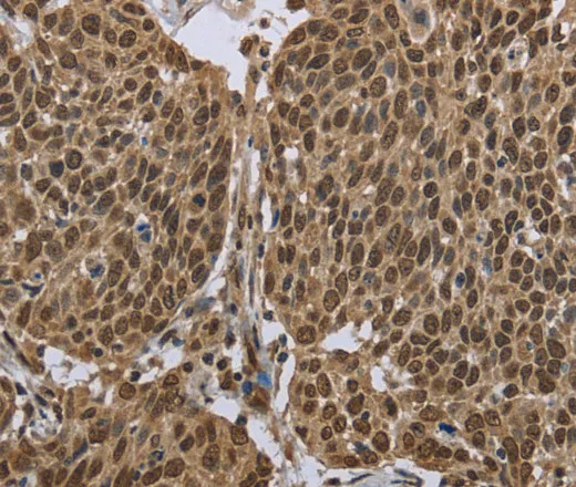 PPAT Polyclonal Antibody - image 1