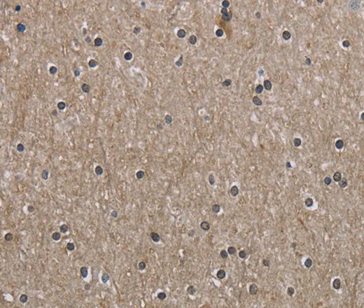 PPAT Polyclonal Antibody - image 2