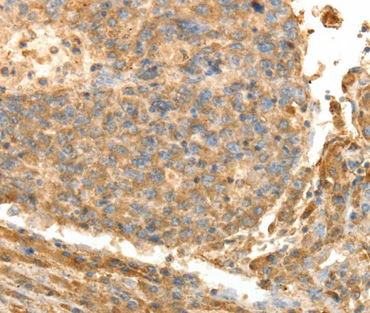 PSMD9 Polyclonal Antibody - image 1