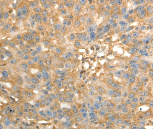 PSMD9 Polyclonal Antibody - image 2
