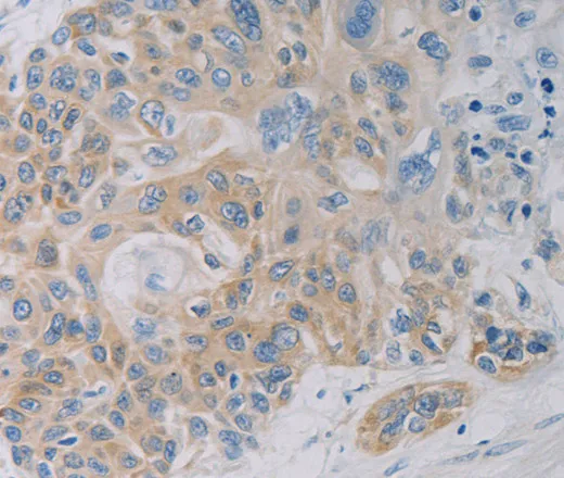 CD303 Polyclonal Antibody - image 1