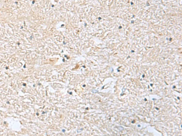 EIF4A2 Polyclonal Antibody - image 1